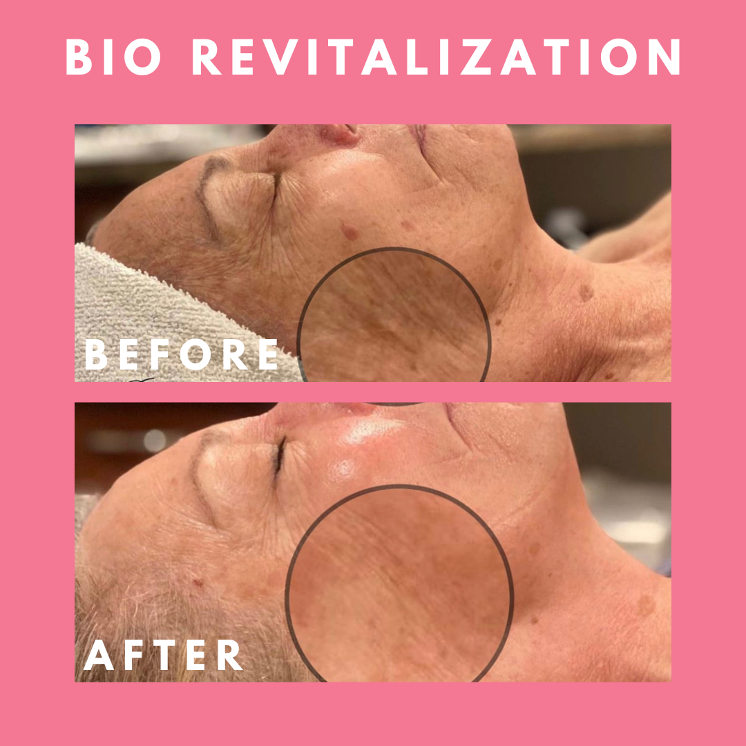 bio ret