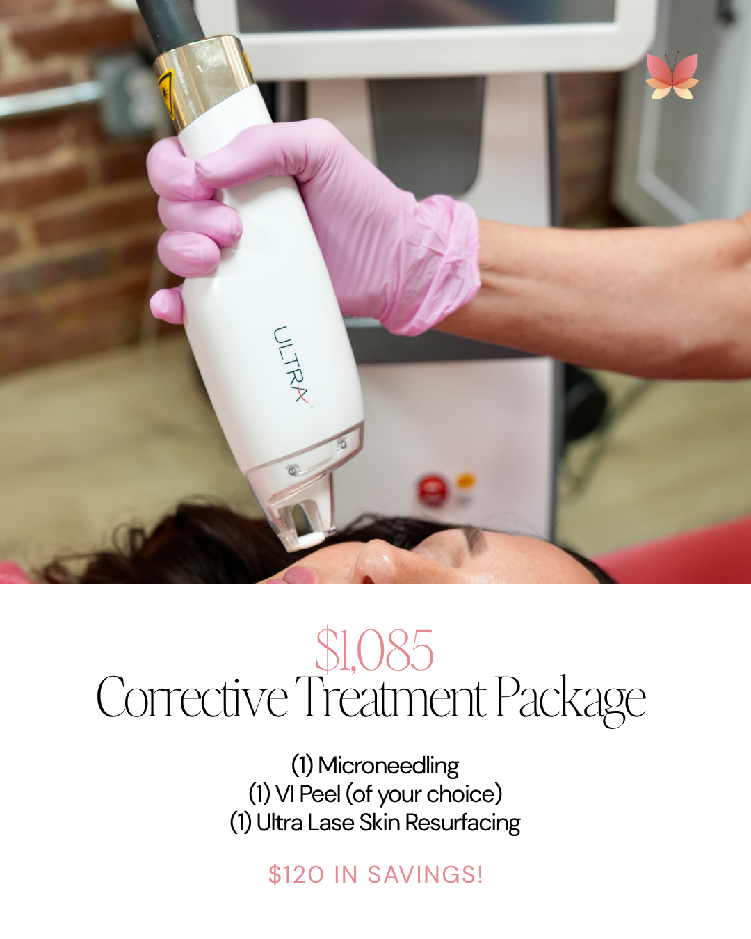 corrective treatment package oct 26